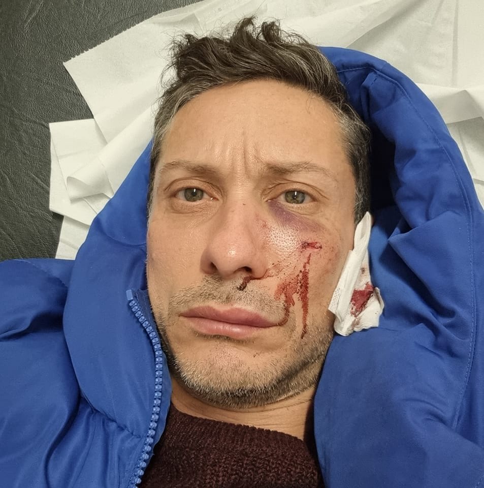 Aggredito a Parigi l'attore e regista mazarese Vito Gennaro Giacalone