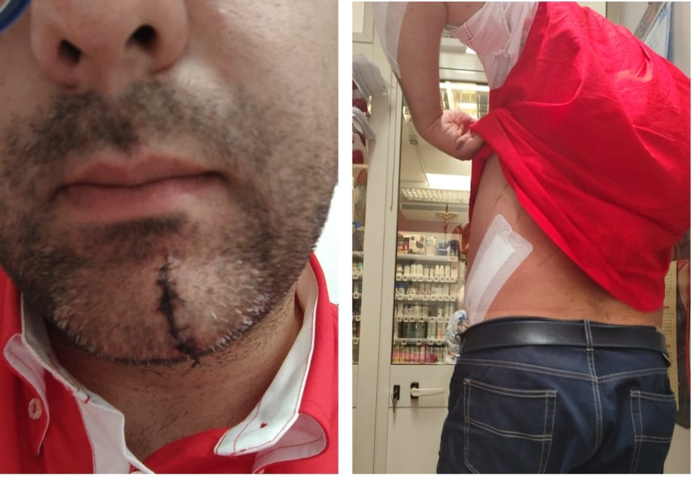 Aggredito a Salemi e ferito un noto medico, stava difendendo un disabile