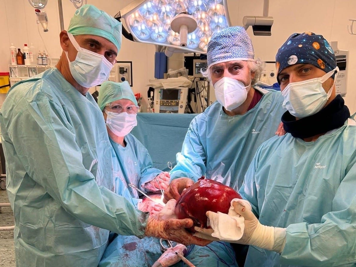 Asportato tumore di oltre 5 kg, intervento all’ospedale Abele Ajello di Mazara del Vallo