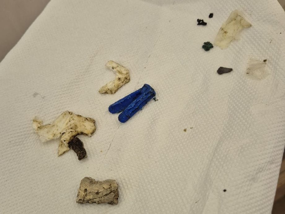 Favignana. Tartarughe in difficoltà a causa della plastica ingerita, curate e salvate