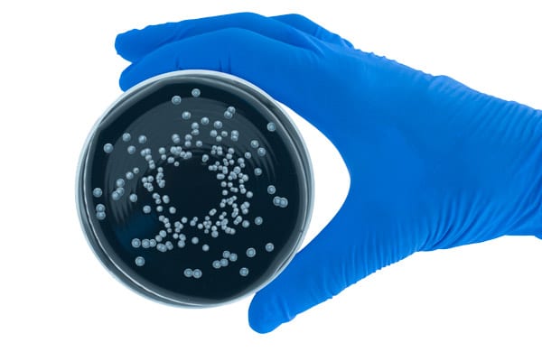 Caso di Legionella ad Alcamo, 55enne in gravi condizioni: scattano le verifiche dell’Asp