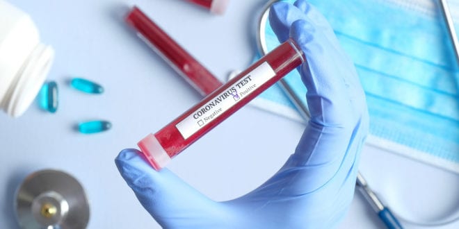 Coronavirus, crisi negozi Cinesi. Psicosi ad Alcamo