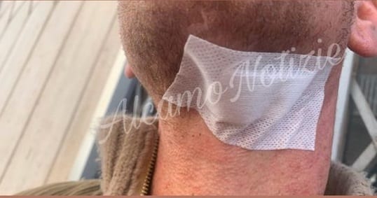 Alcamo, accoltellamento durante il "Carnevale". Denunciato tunisino