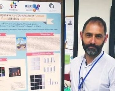 Cnr. Ricercatore alcamese e palermitano “Il Covid 19 può causare danni anche al cervello”