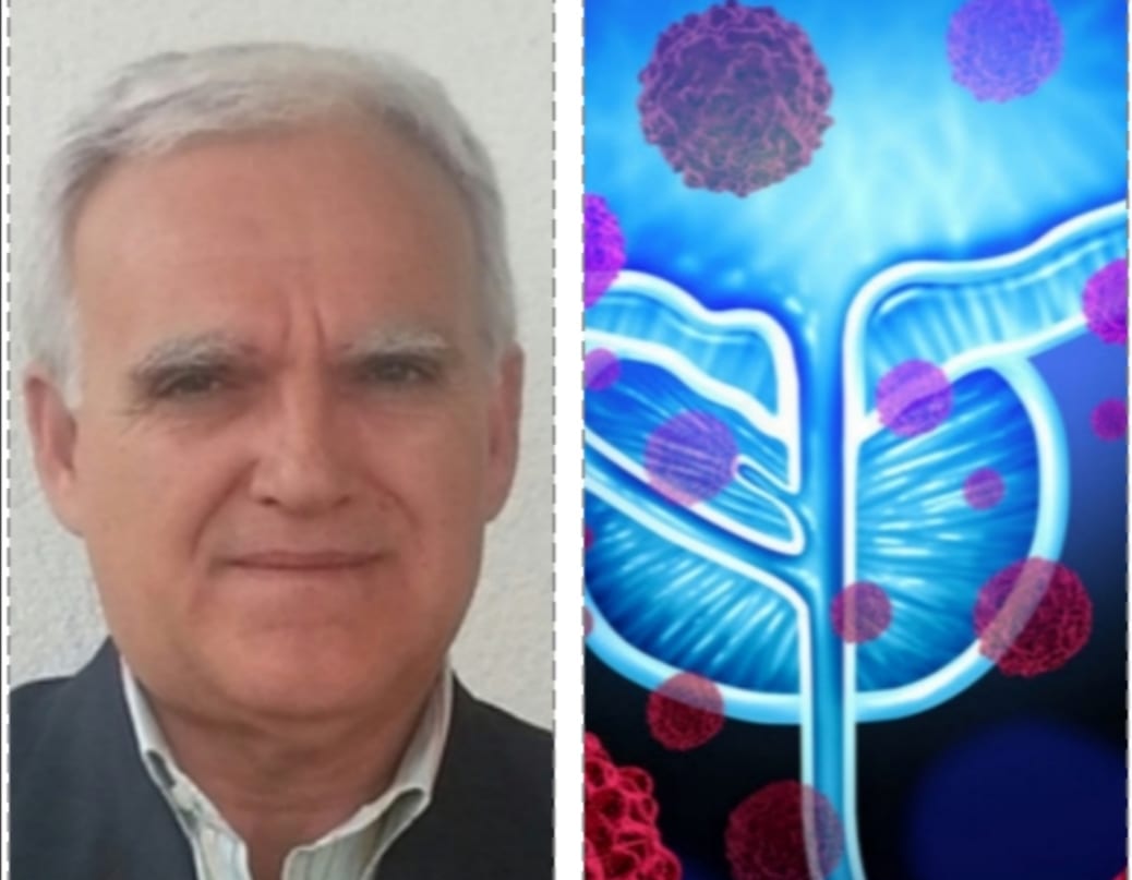 Tamponi ed esami per prostata, laboratorio eccellente. Lo dirige un alcamese