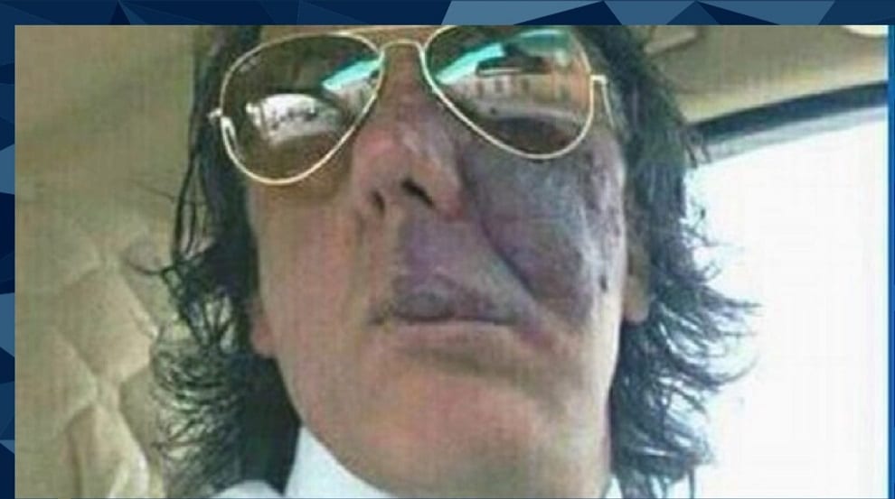 Abusi sessuali su pazienti sedati. Infermiere di Marsala 'libero' in anticipo. Affidato ai servizi sociali